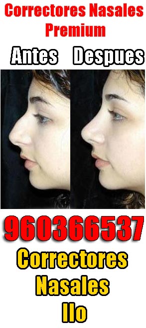 Correctores nasales Ilo