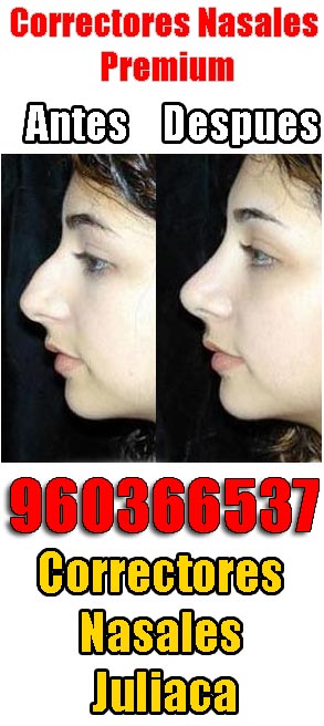 Correctores nasales Juliaca