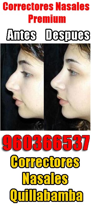 Correctores nasales Quillabamba