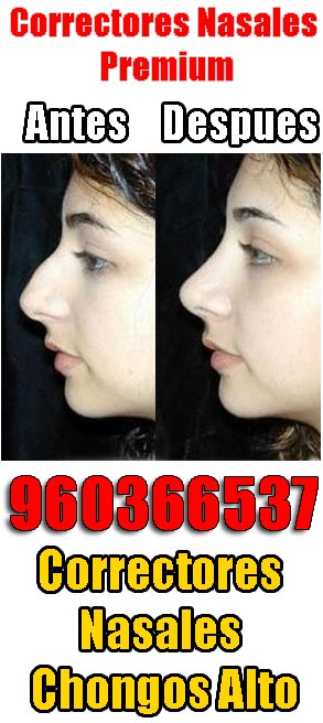 Correctores Nasales Chongos Alto