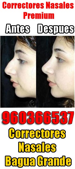 Correctores nasales Bagua Grande