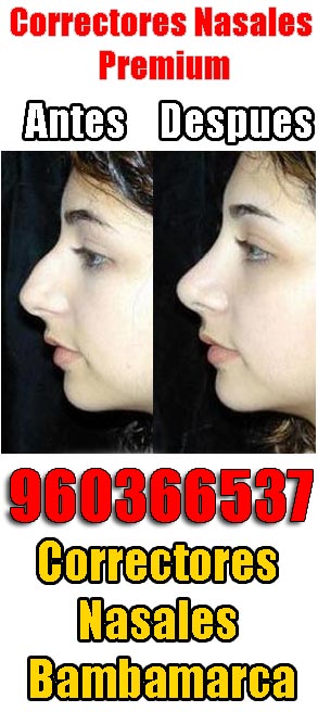Correctores nasales Bambamarca