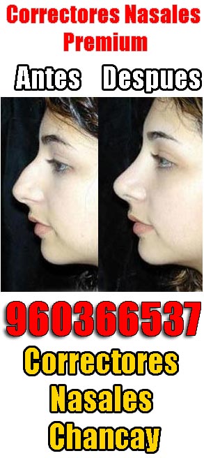 Correctores nasales Chancay