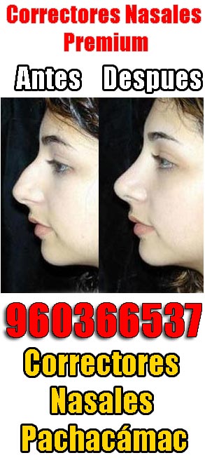 Correctores nasales Pachacámac‎