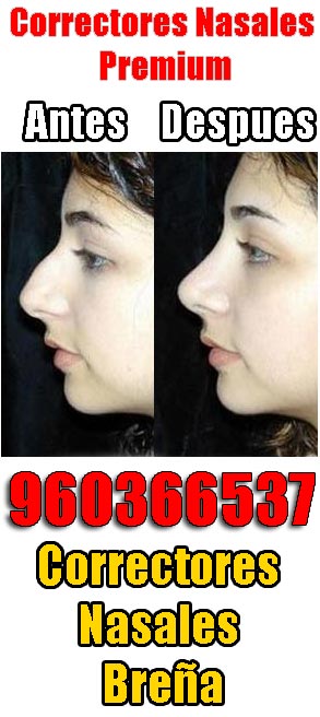 Correctores nasales Breña‎