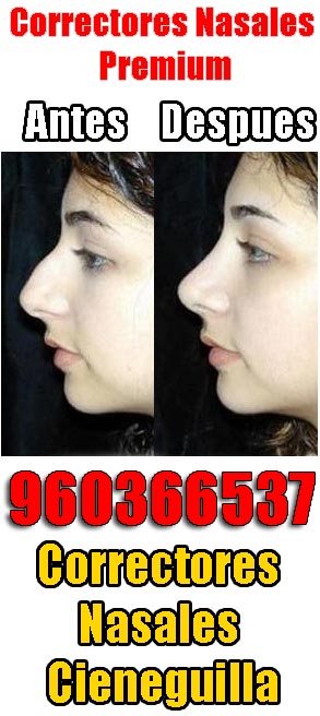 Correctores nasales Cieneguilla‎
